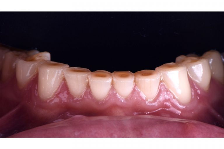香港大學牙醫學院修復齒科臨床助理教授林東鏵醫生