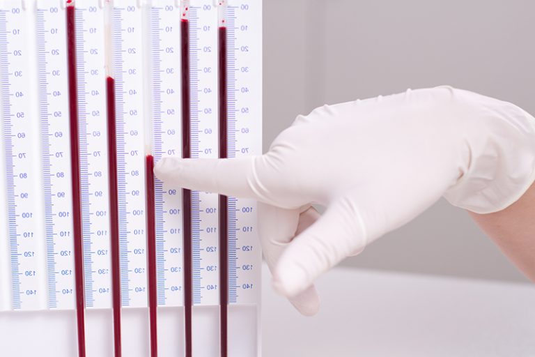 血沉降-Erythrocyte-Sedimentation-Rate,ESR) 身體檢查揭罕見病-血沉降指數-內科專科陳鎮中醫生