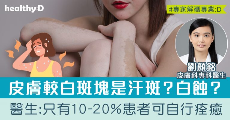白蝕(又稱白斑、白癜風)會否自行痊癒？皮膚科醫生詳解白蝕成因及治療方法