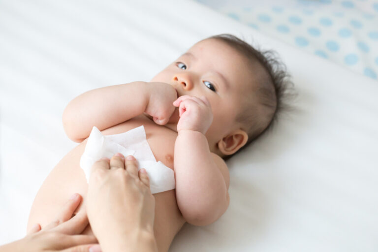 肚臍疝氣|肚臍疝氣嬰兒的日常護理