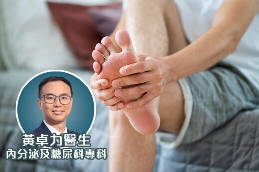 【糖尿腳=爛腳？】糖尿腳嚴重可致截肢？醫生拆解糖尿腳成因、正確處理傷口小貼士