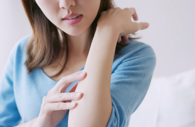 乾燥綜合症-治療-中醫食療建議-基督教聯合那打素社康服務