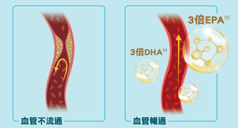 三高年輕化-改善壞指數-攝取魚油助你清走血管垃圾