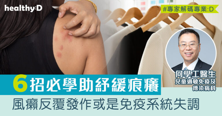 蕁麻疹｜紅疹、痕癢出風癩怎麼辦？反覆發作或是免疫系統失調 醫生建議6招紓緩症狀