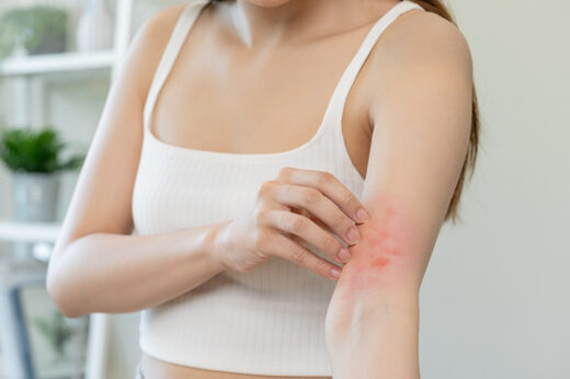 皮膚癬 | 痕癢症狀與濕疹相似易混淆！醫生帶你認識皮膚癬原因及正確治療方法