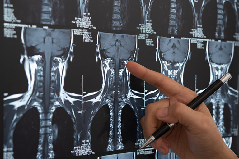 頭頸癌-肛門癌-陰道癌-外陰癌-HPV感染-成因-症狀-高危群組-cancercare.hk