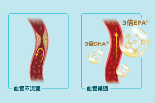 三高年輕化｜只靠做運動/調整飲食改善壞指數？攝取魚油助你清走血管垃圾