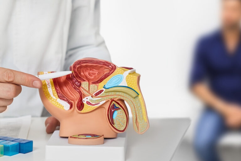 前列腺癌檢查|39歲港男無明顯病徵 體檢揭患早期前列腺癌!醫生拆解前列腺癌症狀、高危因素、檢查及治療