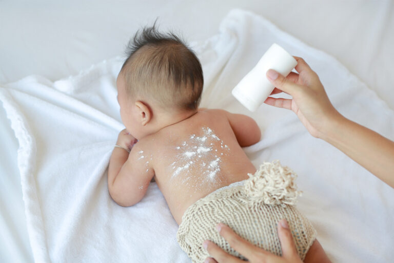 BB熱痱|嬰幼兒皮膚出紅疹,是生熱痱嗎?了解熱痱特徵、位置及生熱痱搽咩好