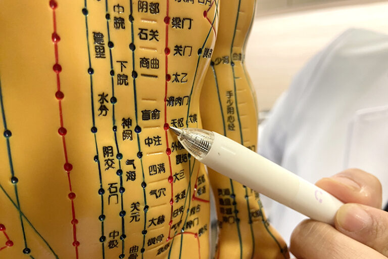 經痛月經遲來-中醫婦科治療-朱古力瘤-多囊卵巢綜合症-根治-德善醫療