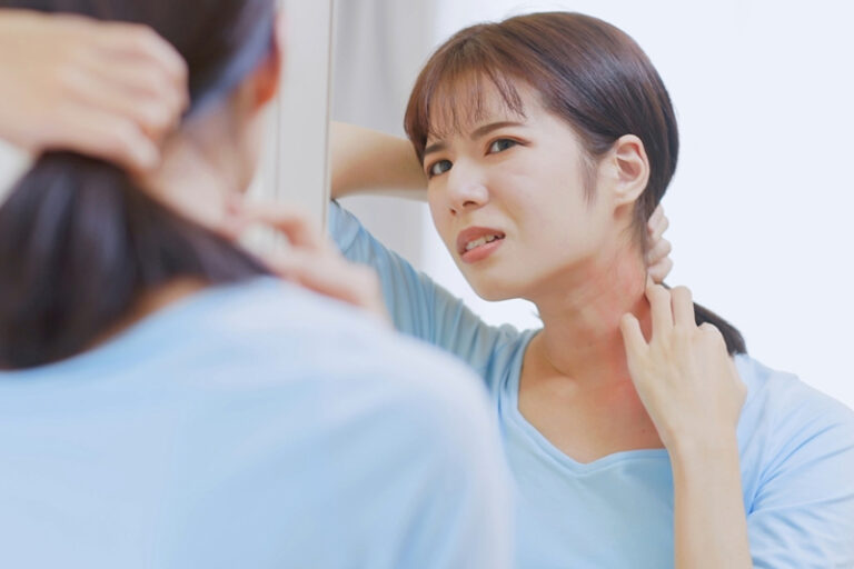 濕疹大爆發！皮膚「出水」紅腫痕癢怎麼辦？中醫拆解慢性濕疹治療方案