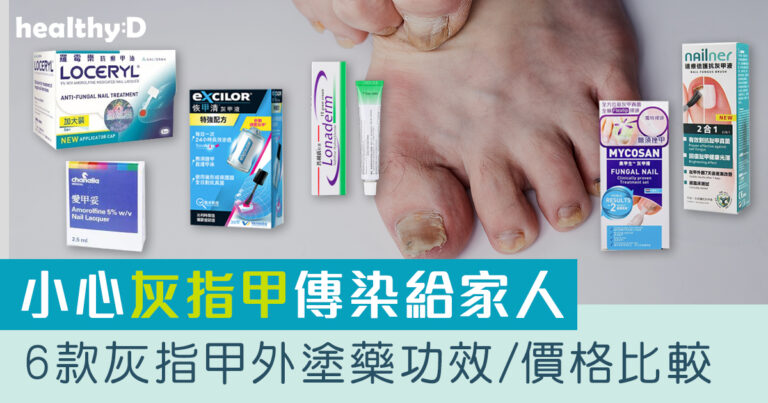灰甲藥推薦2026 | 灰指甲會傳染？6款治療灰指甲外塗藥膏/抗甲癬油劑的功效/價格比較：羅霉樂(樂指利)/恢甲清/愛甲妥