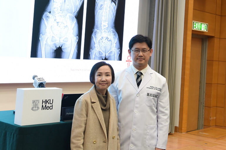 脊柱側彎原因｜港大中大研究揭青少年原發性脊柱側彎患者的遺傳成因 冀有助研究新療法