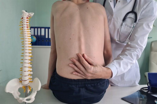 脊柱側彎原因｜港大中大研究揭青少年原發性脊柱側彎患者的遺傳成因 冀有助研究新療法