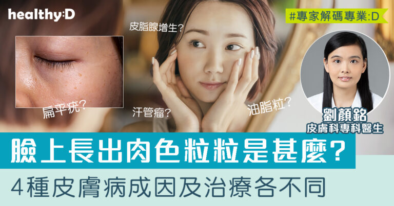 臉上肉粒是扁平疣、汗管瘤、粟粒疹(油脂粒)或皮脂腺增生？皮膚科醫生詳解4種皮膚病原因、症狀及治療方法