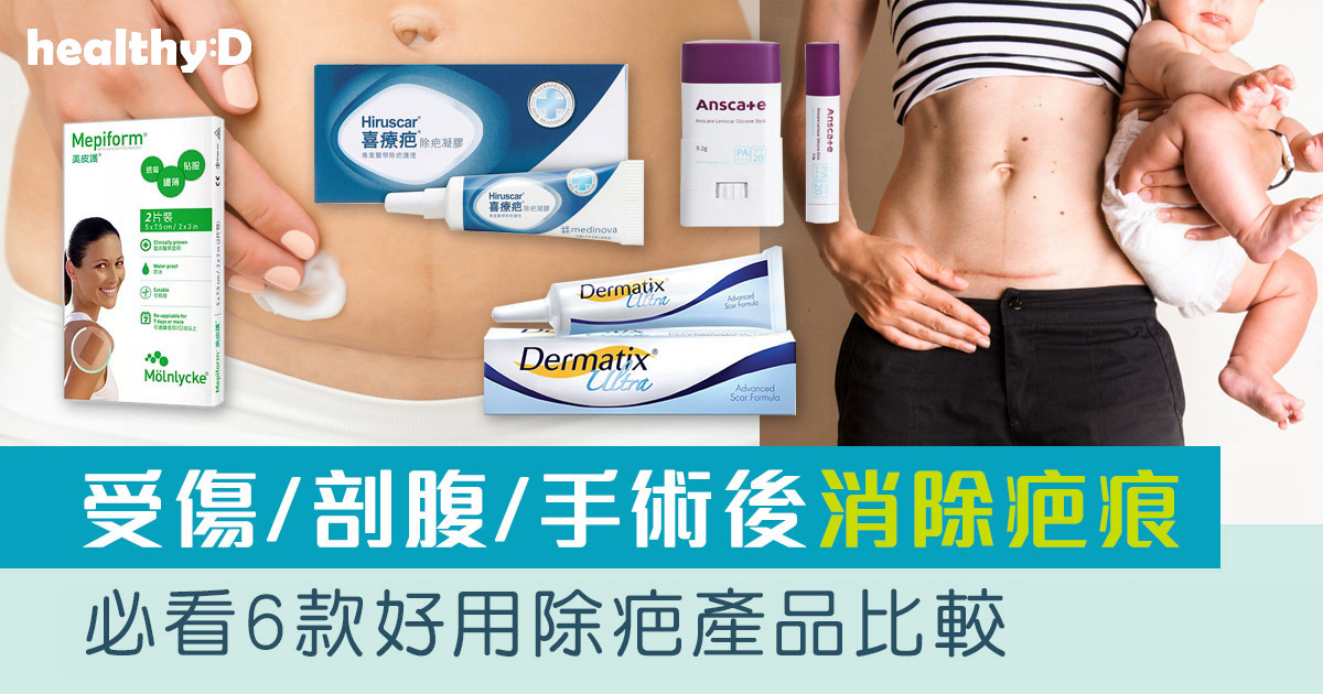 除疤膏推薦 | 淡化傷口/手術開刀/剖腹生產疤痕 6款好用除疤藥膏/除疤筆/除疤貼比較（消委會教揀選貼士+醫生拆解去疤原理）