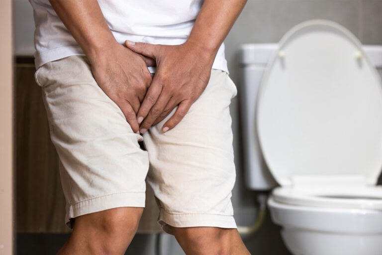 中大研究揭良性前列腺增生患者染新冠後 泌尿系統出現併發症風險增