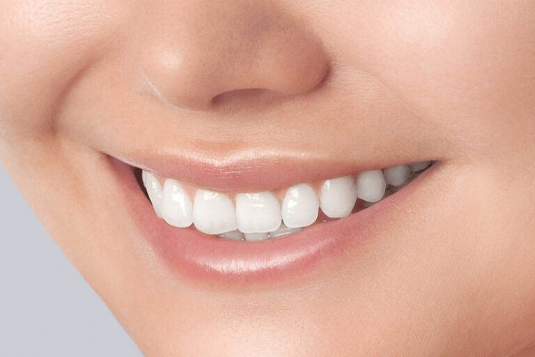 牙齒變灰|四環素可致牙齒染色? 牙科醫生拆解四環徽素對牙齒的影響