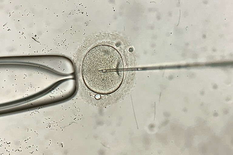 IVF試管嬰兒-體外受孕-人工授孕-IUI-費用-不育原因-治療方法-流程 + 瑪麗醫院-威爾斯親王醫院補助-公家症-私家症-仁安-養和-輔助生育中-手術項目-費用比較