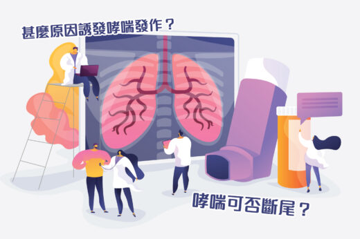 哮喘症狀能否根治？呼吸系統科醫生講解嚴重哮喘/哮喘病作病徵、急救、食療及預防發作方法