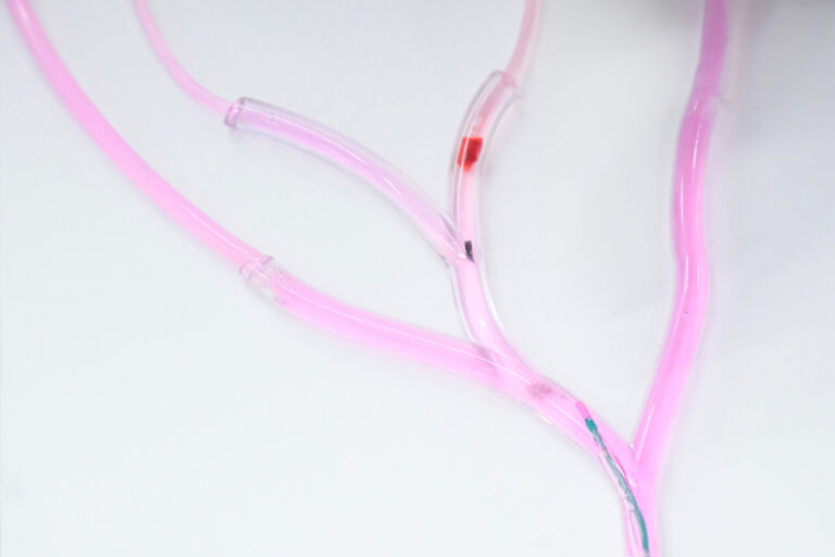 科學新知｜中大研發新型納米機械人增強溶栓效果 較傳統治療快20倍 助減中風患者腦損傷