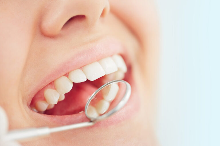 智慧齒|無痛無腫便不用剝智慧齒?智慧齒橫生怎麼辦?(附脫牙後護理貼士)