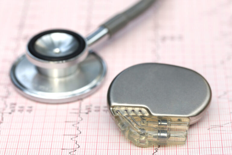 心律不正|阿諾舒華辛力加患先天性心臟病 上月出現心律不正 決定植入心臟起搏器|醫生分享使用注意事項