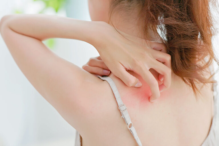 【DSE考生補腦法寶、補腦食物推介】 考生補腦攻略 遇上換季敏感如何顧好免疫力？