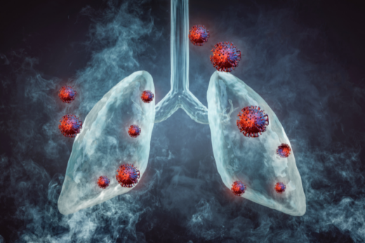 肺癌治療 | 一文看中醫藥如何結合標靶治療調治肺癌