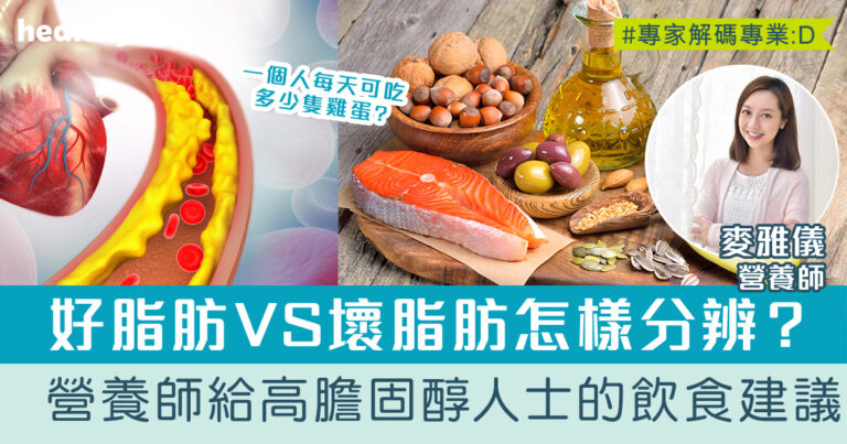 膽固醇FAQ | 好脂肪VS壞脂肪怎樣分辨？營養師建議控制膽固醇的飲食方法