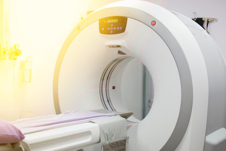 肺癌篩查計劃|肺癌先兆不明顯?低劑量胸腔電腦斷層掃描檢查LDCT邊間好?