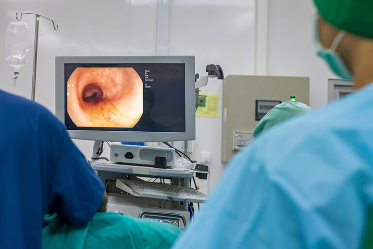 照腸鏡-腸內視鏡檢查-照腸鏡邊間好-檢查中心費用-claim保險-政府政府大腸鏡檢查資助-免費檢查-大腸癌-大腸瘜肉-息肉