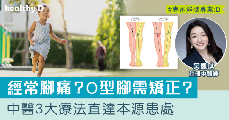 足部問題治療 | 膝痛、腳踝痛、跟膜炎、O型腳、X型腳成因為何？中醫正骨、針灸及刺血拔罐療法作治療直達患處