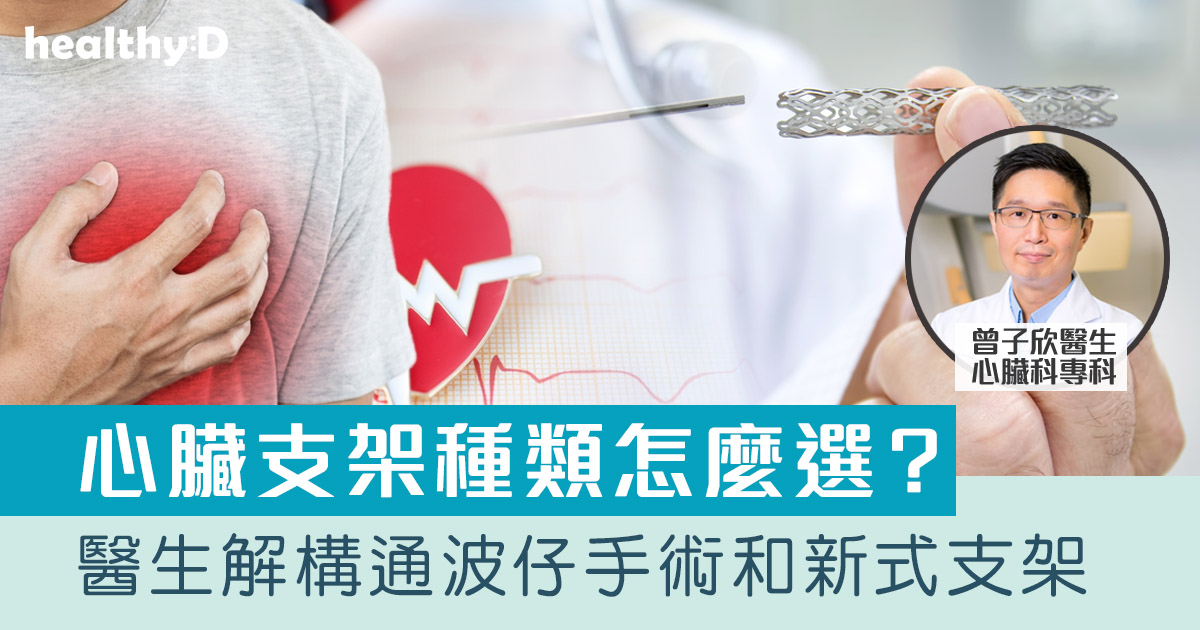 心臟支架|冠心病一定要通波仔?心臟支架種類怎麼選?醫生解構通波仔手術和新式支架 | healthyD.com