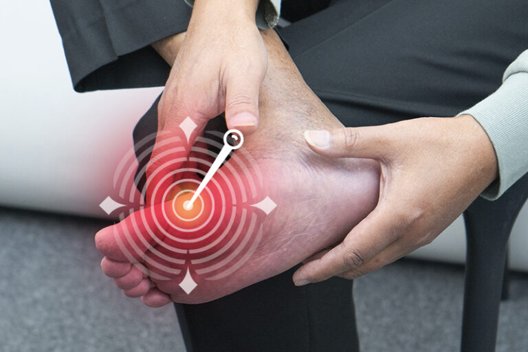 尿酸過高症狀-尿酸過高原因