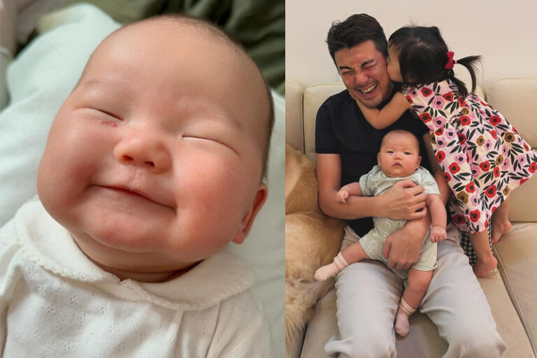 士多啤梨痣｜洪永城細女眼肚長血管痣 梁諾妍憂近眼會影響視線｜醫生拆解草莓血管瘤成因