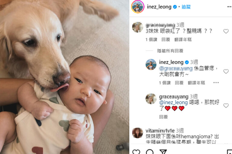 士多啤梨痣｜洪永城細女眼肚長血管痣 梁諾妍憂近眼會影響視線｜醫生拆解草莓血管瘤成因