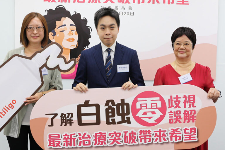 白蝕症｜60歲女全身突長白斑 影響外觀社交 難過被歧視險輕生：覺得白蝕會傳染