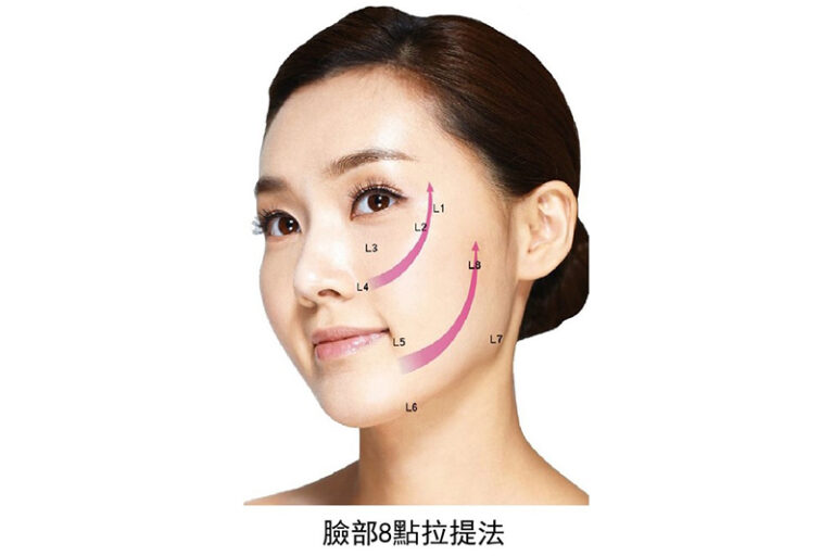 醫學美容-醫生教你選擇皮下填充劑-透明質酸-聚左乳酸-微晶瓷