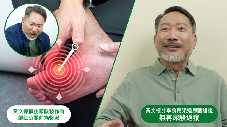 尿酸-尿酸過高原因-尿酸超標