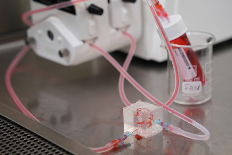 肝癌｜摘日內瓦發明展金獎！港大醫學院創全球首個仿生「肝立方」 助肝癌病人精準評估治療效果