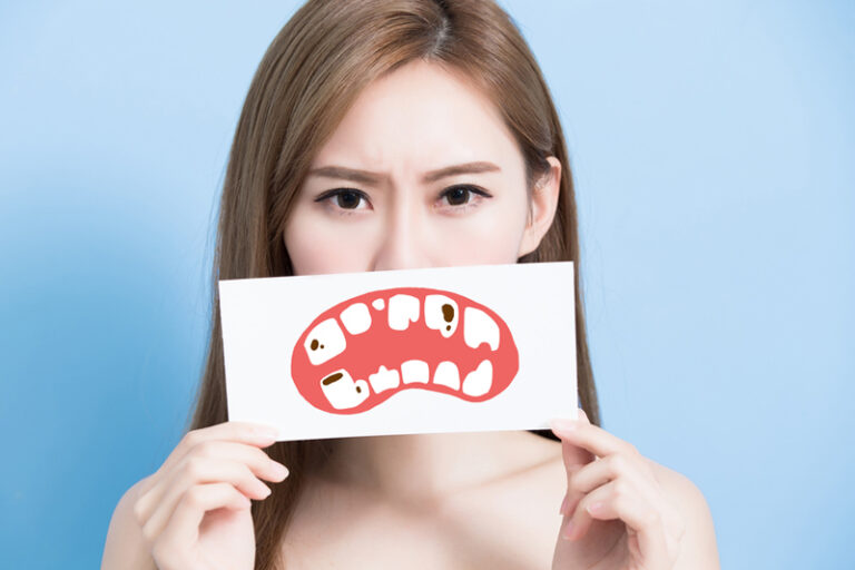 蛀牙｜懷孕為甚麼易蛀牙？何時開始預防蛀牙？從懷孕前注重口腔健康護理