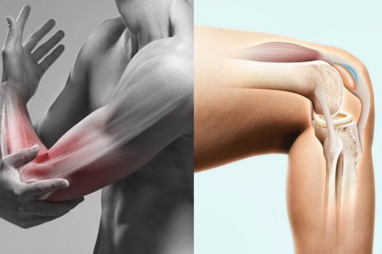 關節保健品挑選原則大公開!蛋殼膜、膠原蛋白能保健關節?藥劑師教你保護關節骨骼及肌肉力量 必知2大重點