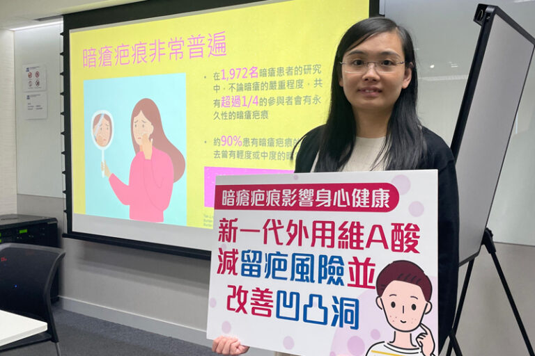 生暗瘡|陽光照射會加劇暗瘡問題?醫生籲正確處理避免留痕