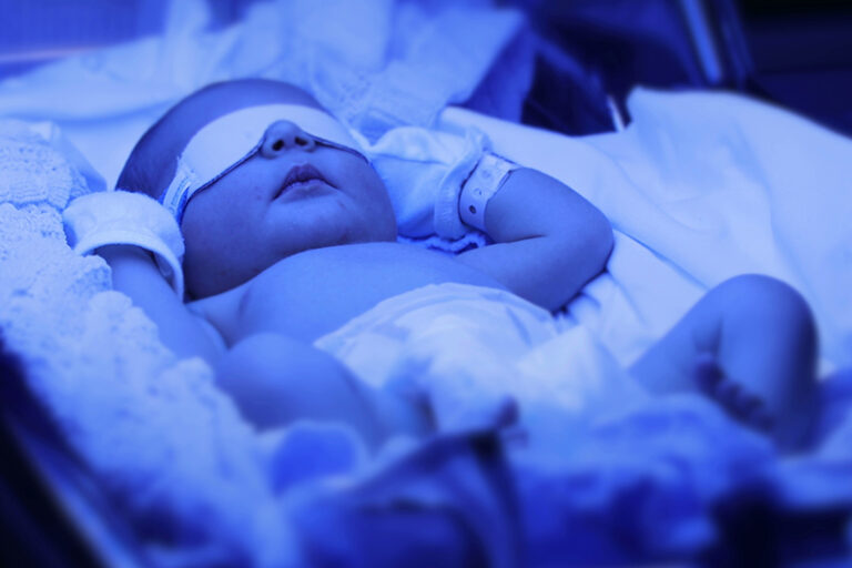 黃疸新生兒-胎黃中醫治療-仁濟醫院中醫師