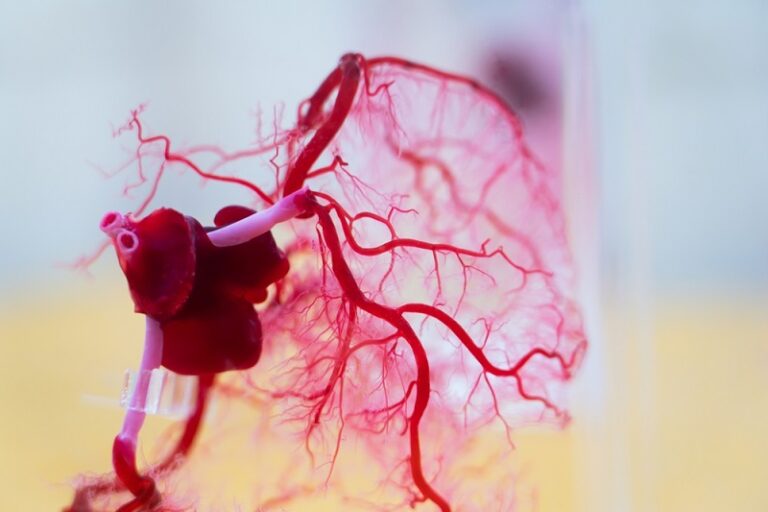 冠狀動脈-冠狀動脈鈣化-心臟病-心臟病風險