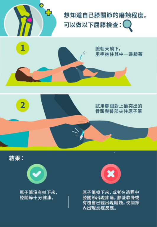 關節磨蝕原因-關節保健品推薦-骨關節痛