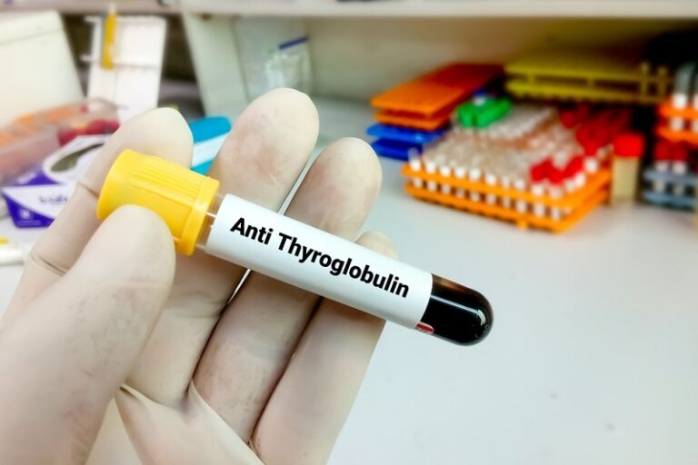 治療再生不良性貧血症-再生不良性貧血症-AA血液