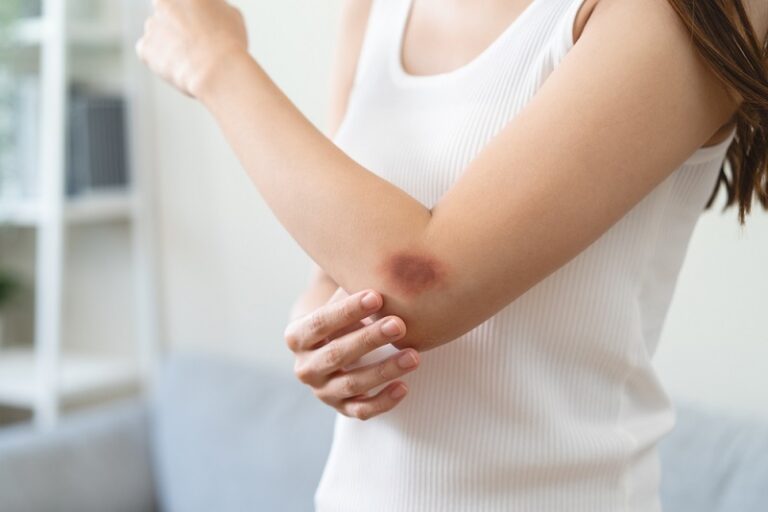 再生不良性貧血症-AA血液