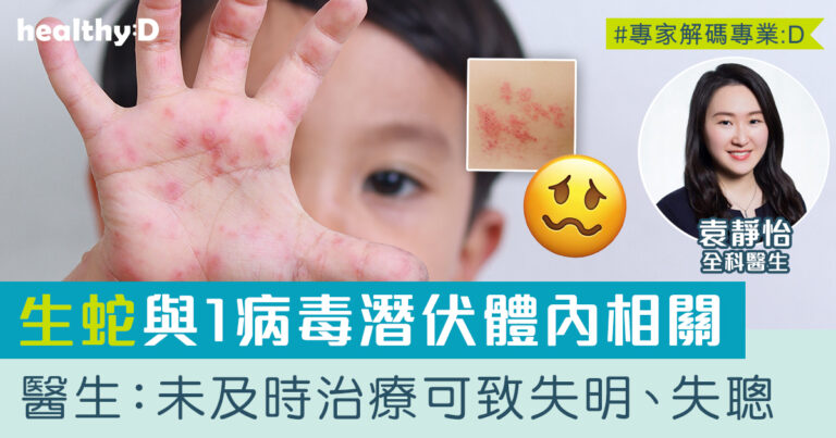 生蛇具傳染性 把握黃金72小時治療！認識帶狀疱疹原因、症狀及治療